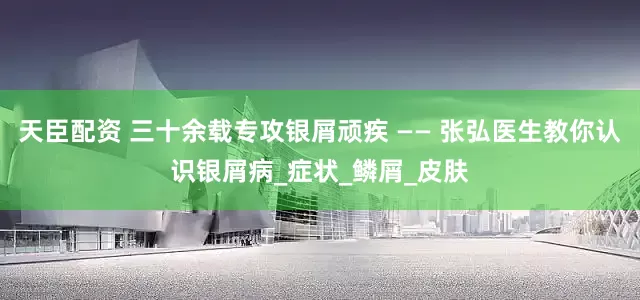 天臣配资 三十余载专攻银屑顽疾 —— 张弘医生教你认识银屑病_症状_鳞屑_皮肤